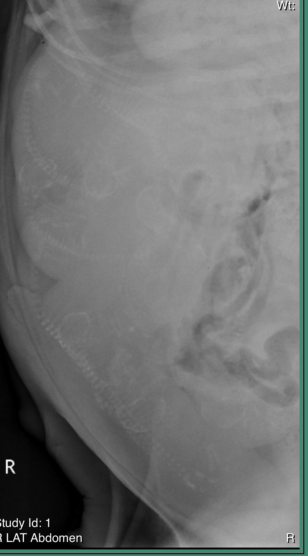 X-ray of Bonnie showing developing Doberman puppies in her belly — pregnancy confirmation